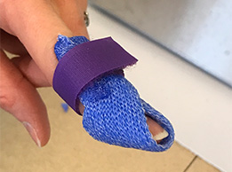 The Mallet Finger Orthosis 15