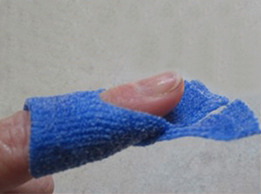 The Mallet Finger Orthosis 6