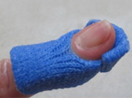 The Mallet Finger Orthosis 7